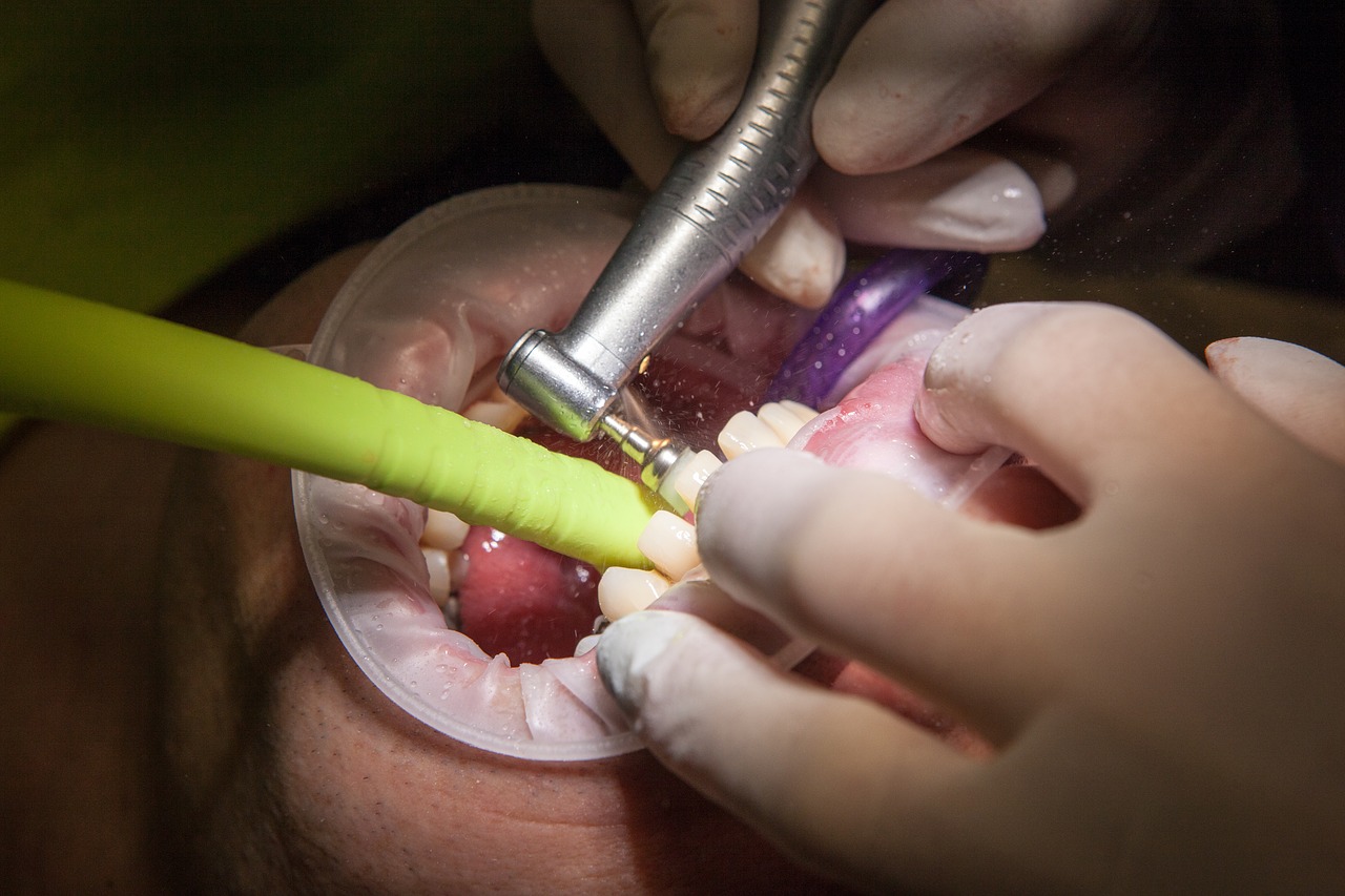 Co to jest i czym się zajmuje chirurgia stomatologiczna?