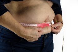 Zmniejszenie żołądka a leczenie otyłości – jak to przebiega?