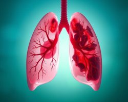 Choroby obturacyjne układu oddechowego: objawy, przyczyny i leczenie