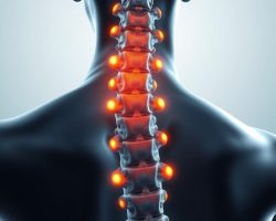 Rwa barkowa: objawy, przyczyny i skuteczne metody leczenia