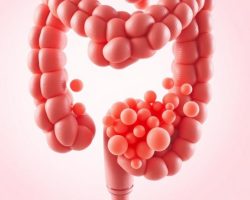 Polipy jelita grubego: rodzaje, objawy i metody diagnostyki