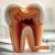 Endodoncja – co warto wiedzieć o leczeniu miazgi zębowej?