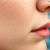Badania na trądzik hormonalny – co warto wiedzieć?