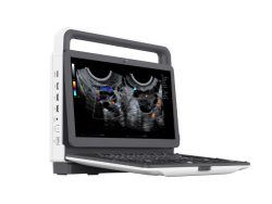 Jak funkcjonuje ultrasonografia? Zrozumienie działania aparatu USG i jego zastosowań w diagnostyce medycznej