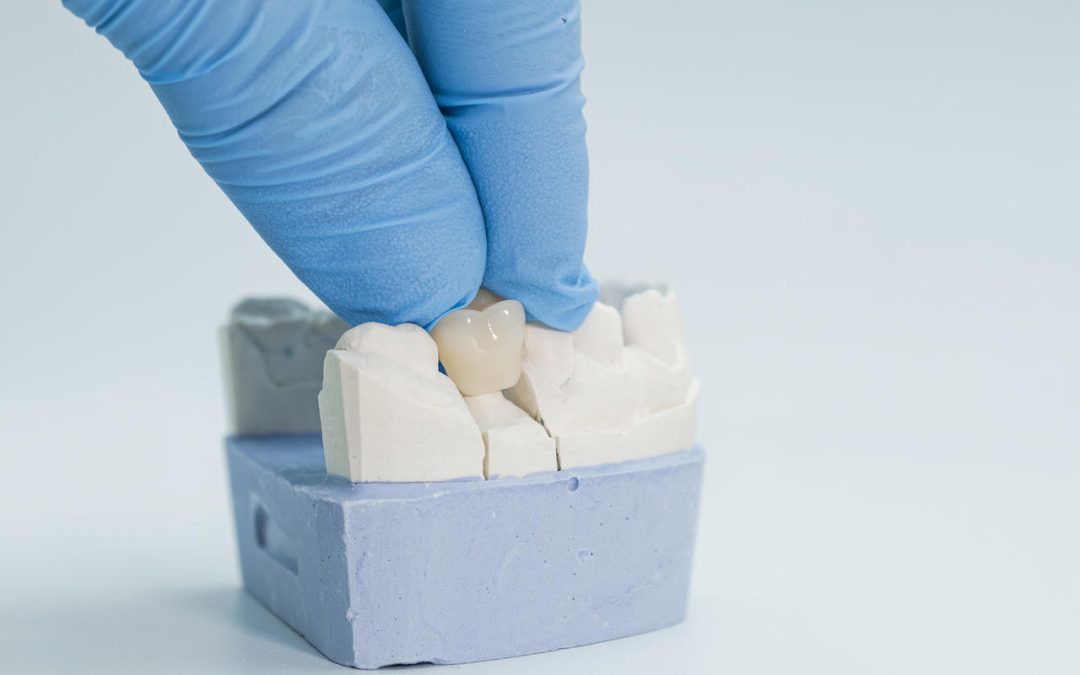 korona porcelanowa protetyk gdańsk