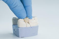 Korony porcelanowe Gdańsk – Zastosowanie i jak wygląda leczenie?